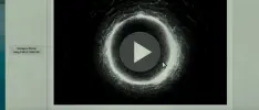 Checa el tétrico tráiler de El Aro 3